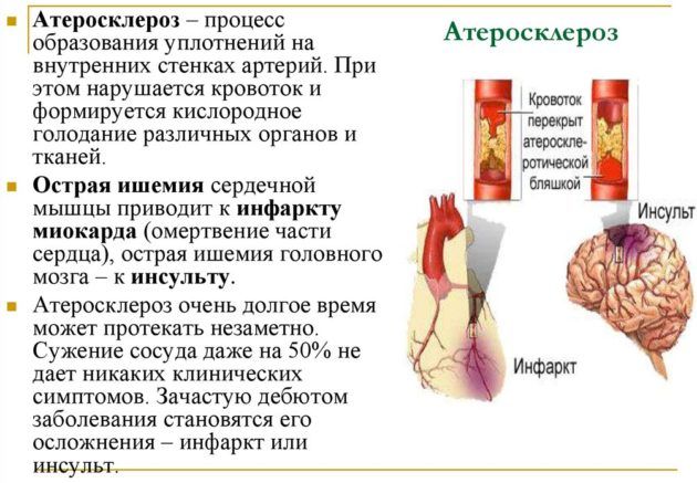 Атеросклероз влечет за собой ухудшение слуха