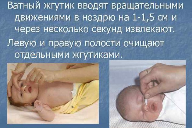 Ватные жгутики