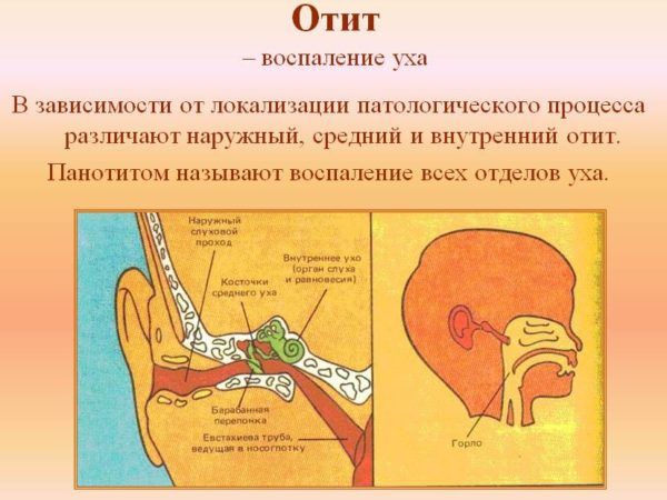 Отит