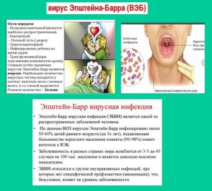 Лечение вируса Эпштейна-Барр