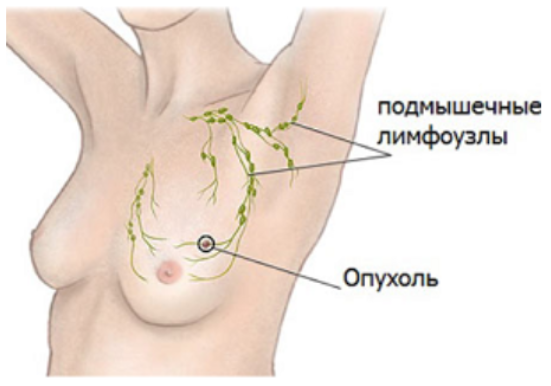 Формирование уплотнений