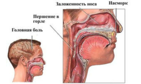 Симптомы