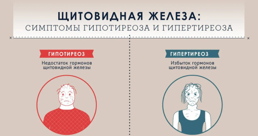 Гормон ТТГ