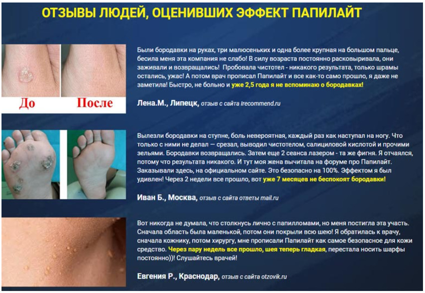 Папилайт – препарат нового поколения от папиллом и бородавок