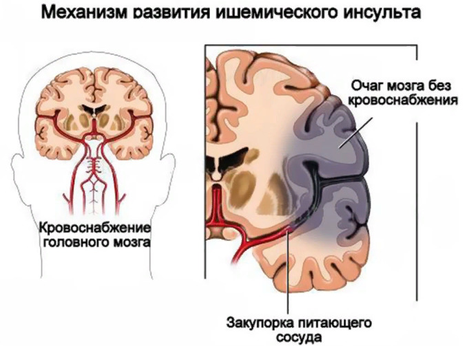 Механизм развития