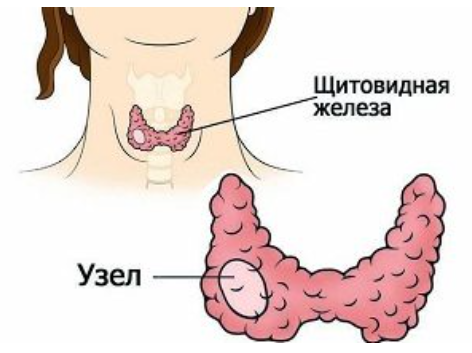 Механизм и причины развития
