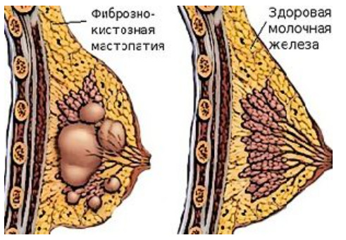 Механизм и причины развития