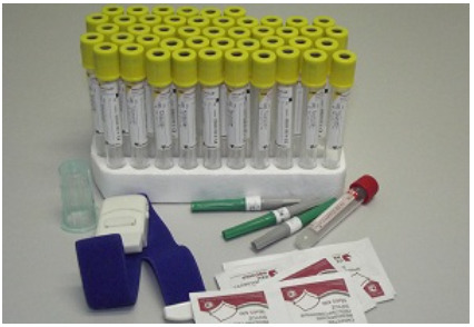 Повышение уровня HbA1c