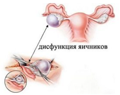 Локализация заболевания 