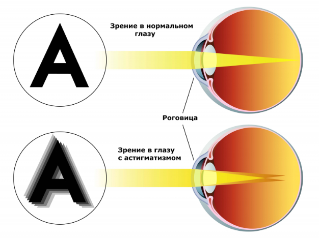 Зрение 