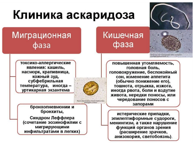 Клиника аскаридоза 