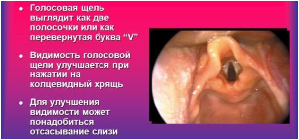 Локализация заболевания 