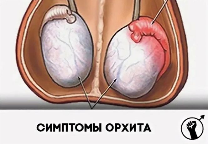 Орхит