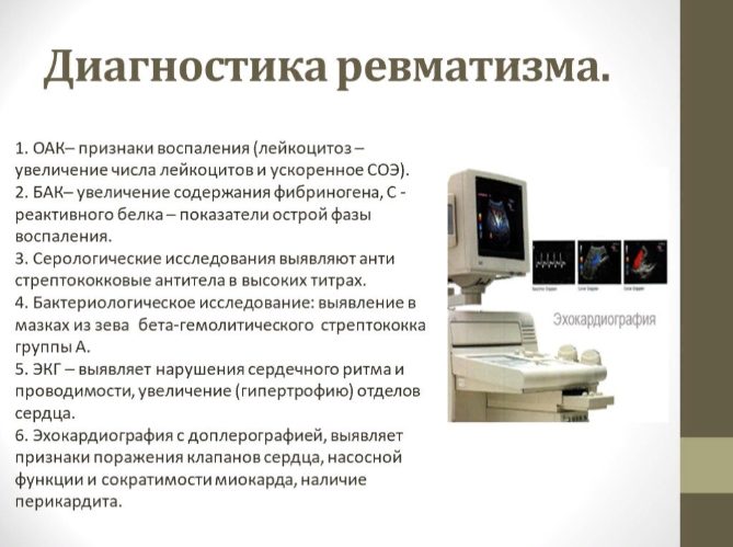 Диагностика и лечение ревматических заболеваний после COVID-19